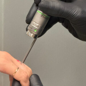 Αφαίρεση-Τατουάζ-Χανιά---Κρήτη